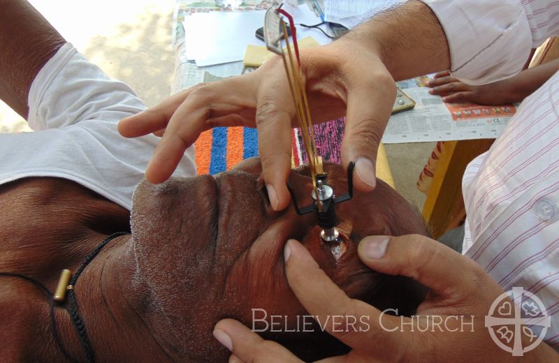 Leprosy Patients Receive Free Eye Checkups in Diocese of Lucknow